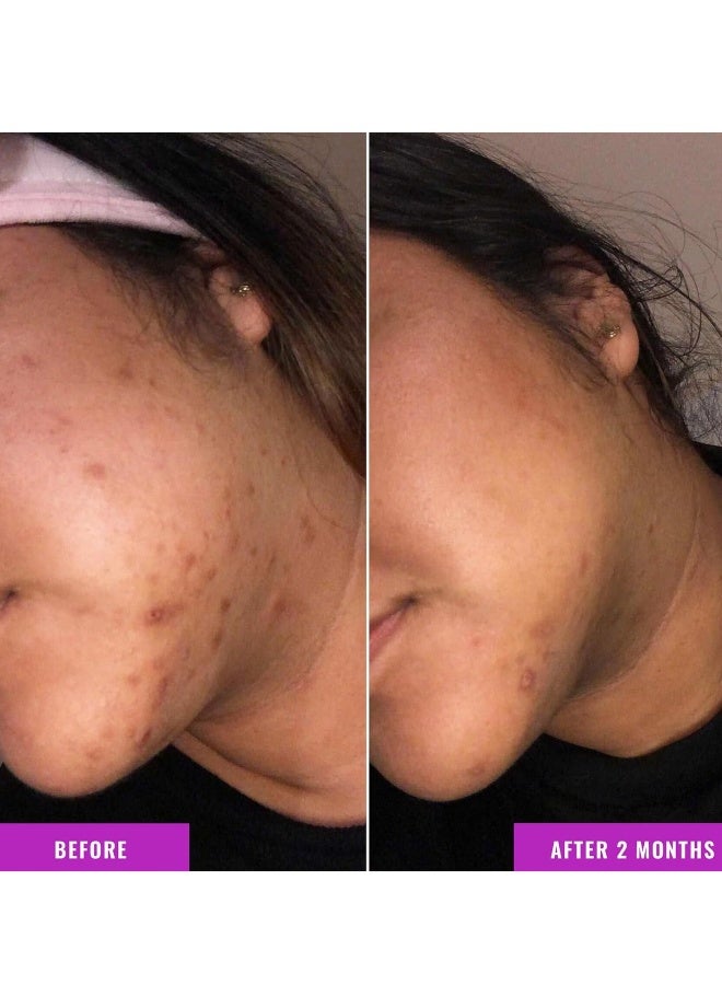 سيروم تصحيح لون الجلد من جود موليكولز - ملح إستر حمض الترانكساميك والنياسيناميد للبقع الداكنة، أضرار الشمس، وبقع الشيخوخة - للعناية بالبشرة وجه - Image 4