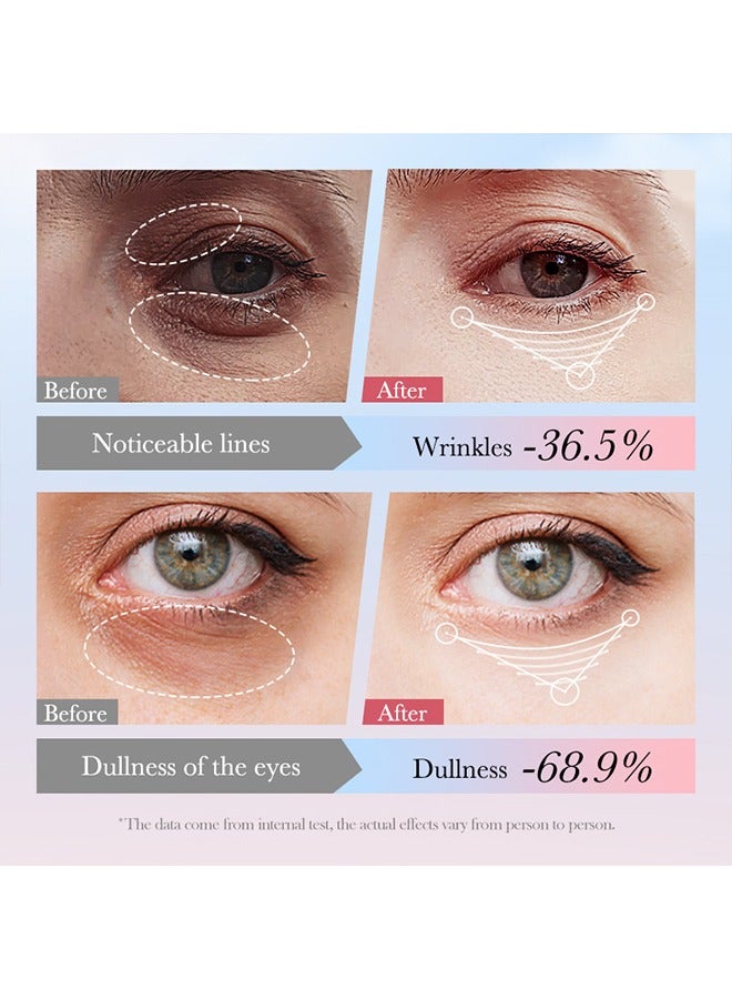 SADOER Roll-on Eye Cream 4 IN 1 Firming & Nourish - ​Fade Fine Lines Reduce Dark Circles Eye Serum Tighten Eye Bags Puffiness Improve Elasticity Eye Treatment Cream 20g - Image 5