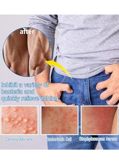 SOUTH MOON Private Antibacterial Cream,Private Itching Cream,External Itching Relief Cream,Fast Relieves The Itching,Male Private Care Itch Relief Cream,Mens Private Part Itching Cream 20g  - Image 5