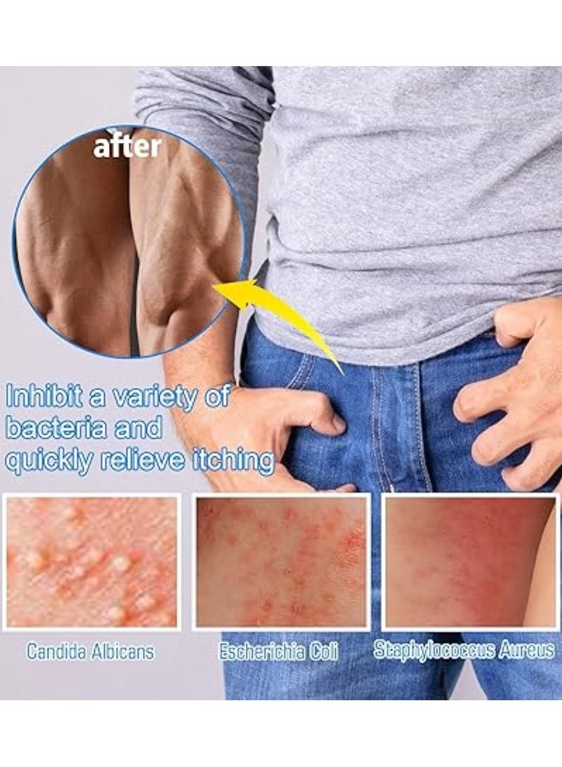 SOUTH MOON Private Antibacterial Cream,Private Itching Cream,External Itching Relief Cream,Fast Relieves The Itching,Male Private Care Itch Relief Cream,Mens Private Part Itching Cream 20g - Image 5