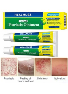 HEALMUSZ 2 Pcs Psoriasis Ointment Herbal Psoriasis Cream Eczema Cream ...