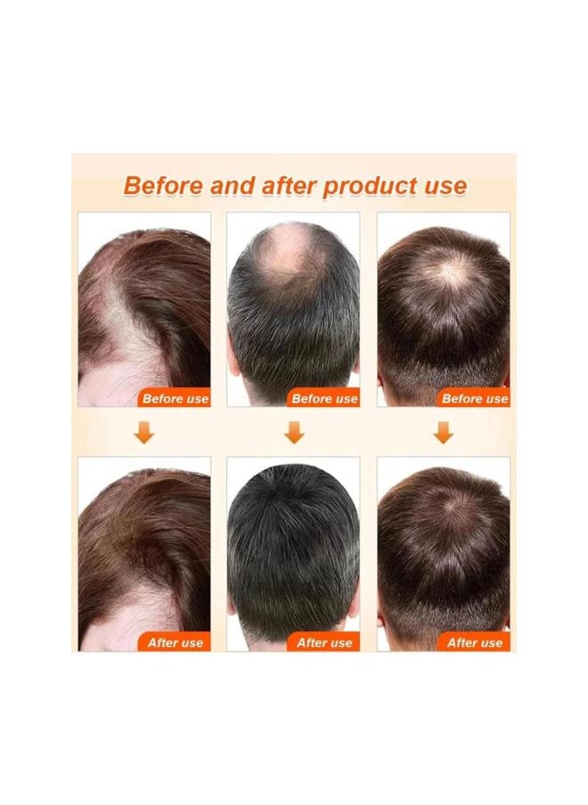 Generic - Hankey Anti-hair loss hair serum, Old Ginger Hair Care Essence Oil, 30ml Hair Growth Serum, Ginger Plant Extract Anti Hair Loss (2Pcs) - Image 1