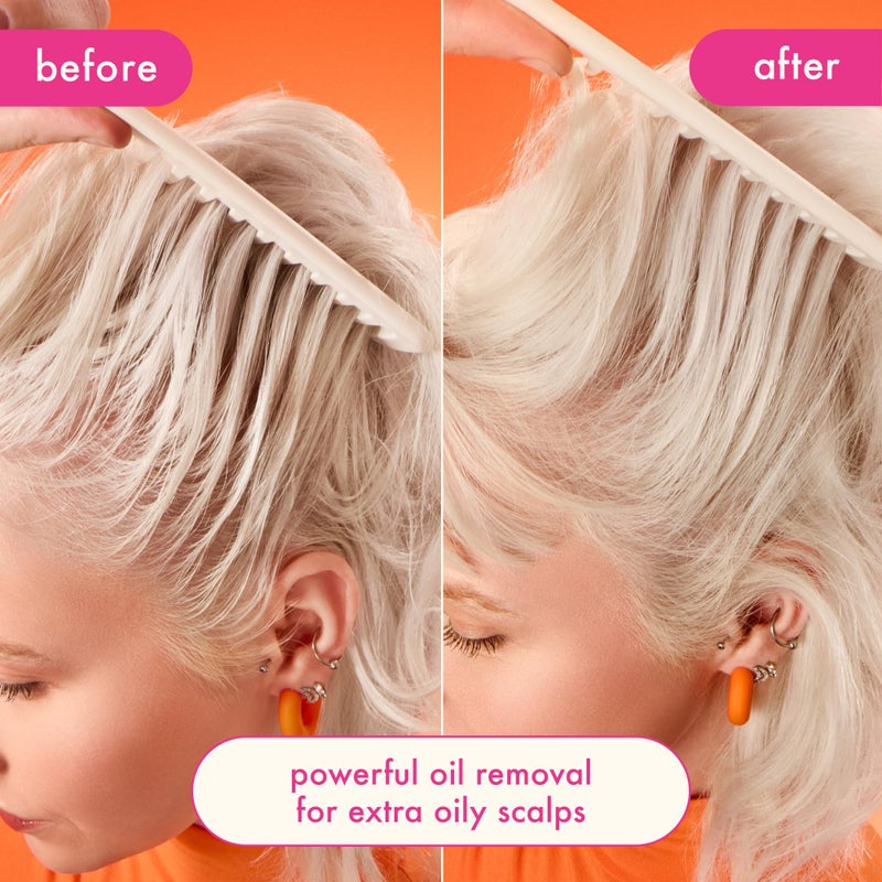 amika شامبو جاف للتحكم في الزيت من أميكا بيرك أب، 5.3 أونصة - Image 3