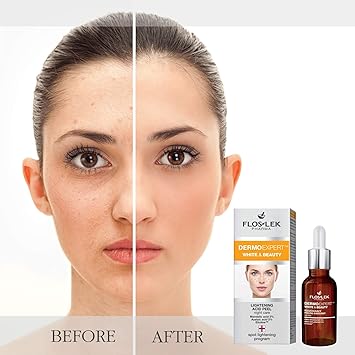 Flos Lek FLOSLEK Whitening Brightening Face Acid Night Peeling 30 ml Lightens Moisturizes Softens Evens Skin Colour Smoother Brighter Complexion Reduces the Intensity of Blemishes - Image 3