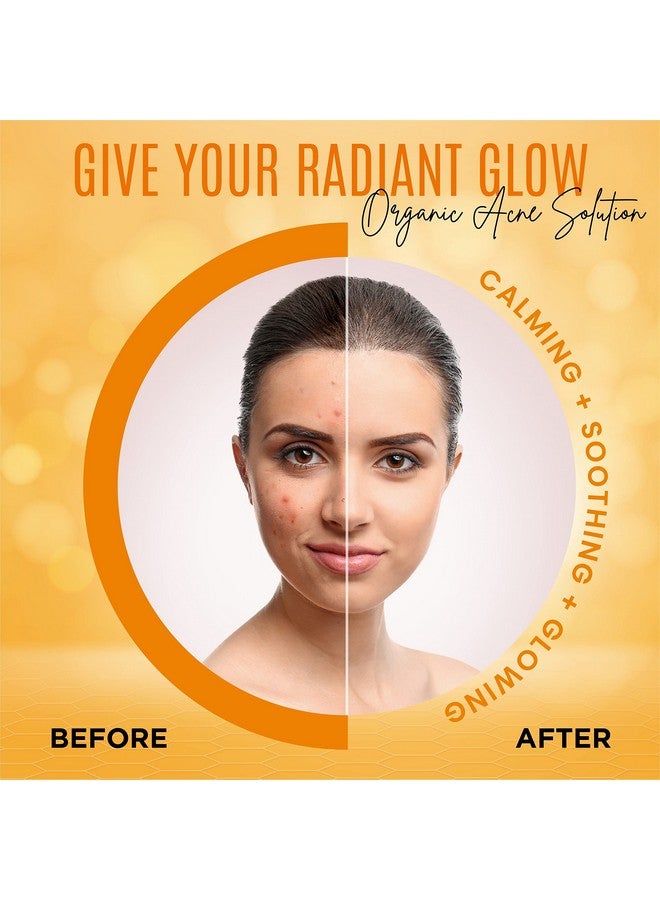 dermaxgen Organic Turmeric Soap Bar Pure Natural Handcrafted Skincare Face & Body Cleanser Blemish Control Reduce Acne Evens Tone Fades Scars Sun Damage Age Spots 3.5 Oz - Image 5