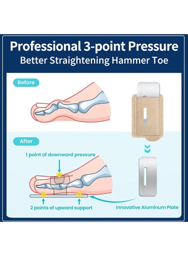 4PCS Fabric Hammertoe Pack, Hammertoe Corrector for Women and Men, Toe Splint for Curved Toes, Curled Toes, Bent Toes and Broken Toes, Toe Fixation Strap (Beige，Black) - Image 4