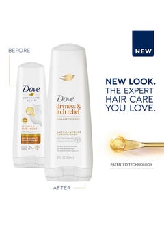 Dove Dermacare Scalp Anti-Dandruff Conditioner Dryness And Itch Relief Dry And Itchy Scalp With Pyrithione Zinc 12 Fl Oz  - Image 4