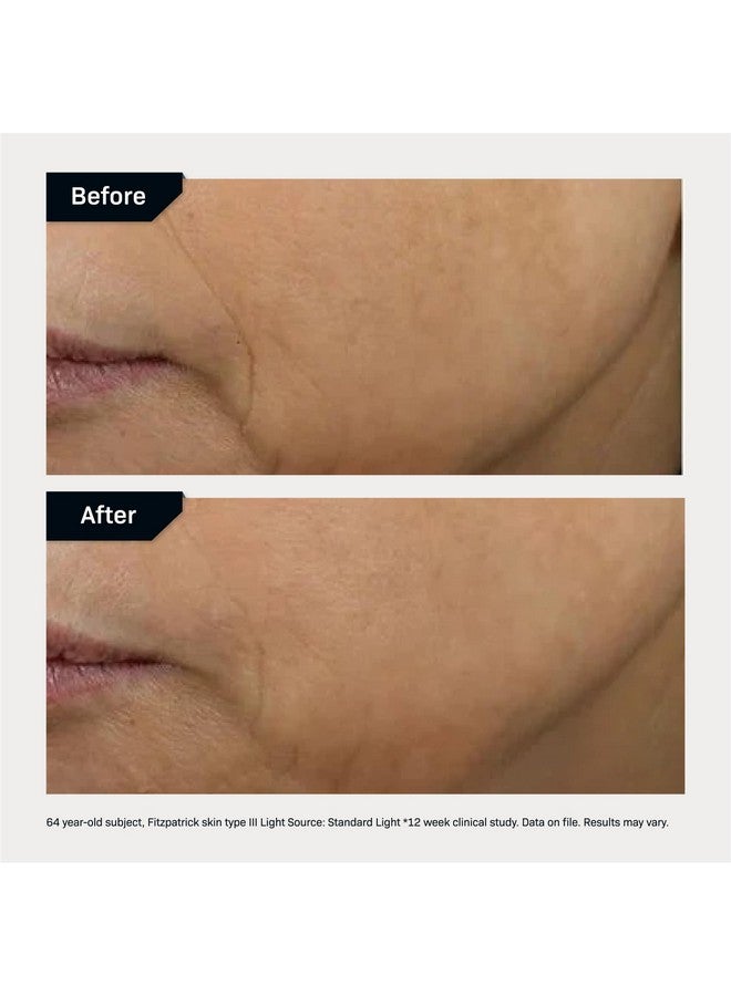 Revision Skincare D·E·J Face Cream®, Advanced Anti Aging Moisturizer, Lifting and Firming, Antioxidant Rich, 0.5 oz - Image 5