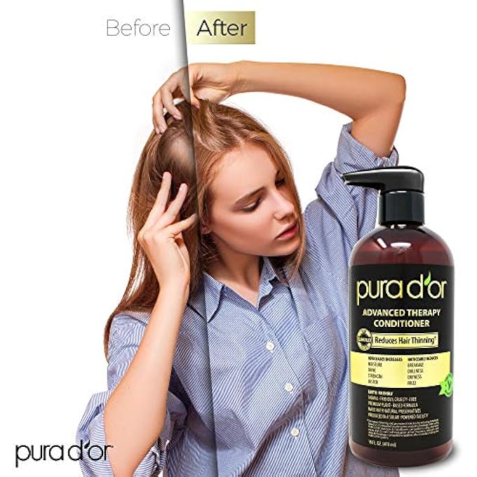 Pura d'or ADVANCED THERAPY CONDITIONER INCREASES MOISTURE AND STRENGTH, SULFATE FREE, INFUSED WITH ARGAN OIL, ALOE VERA, BIOTIN, FOR ALL HAIR TYPES, MEN & WOMEN,16 FL OZ - Image 3