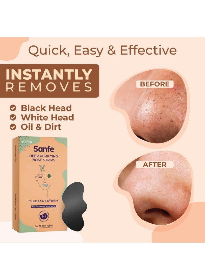 Sanfe Deep Purifying Nose Strips For Women & Men With Fuji Green Tea & Witch Hazel Extracts | Removes Whiteheads | Blackheads And Cleanses Pores (Pack Of 6) | Instant Result - Image 2