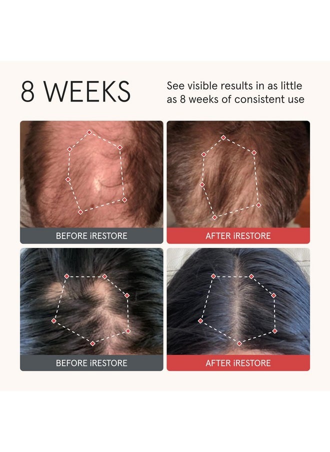 iRestore iRESTORE Biotin Hair Conditioner for Damaged Dry Hair - Biotin Conditioner for Fine Hair Growth, Volumizing Thickening Conditioner with Ginseng & Argan Oil to Moisturize, Pair With Hair Loss Shampoo  - Image 2