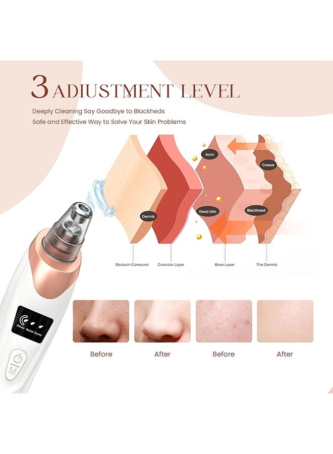 Blackhead Remover Pore Vacuum Cleaner, Facial Pore Cleaner - 5 Suction, 5 Probes, USB Rechargeable Blackhead Vacuum Kit, Electric Acne Extraction Tool for Adults (White) - Image 4