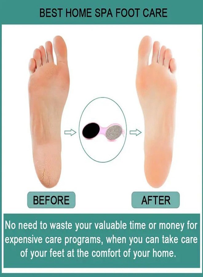 TUSAN 4 in 1 Foot Scrubber for Dead Skin - Pedicure Tool | Pedicure Brush Callus Remover | Repairs Cracked Heels, Dry and Thick Rough Skin, and Foot Corns. - Image 5