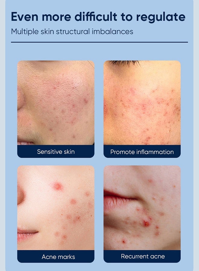 MOIKA Salicylic Acid Acne Removing Essence Gel, Acne Treatment Gel, Acne Spot Treatment for Face & Acne Dots, Natural Cystic Acne Treatment, For All Skin Types, Premium Acne Remover - 20G - Image 5