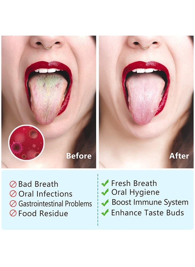 Tongue Scraper (Double-sided tongue scraper cleaner to remove bacteria and fight bad breath) - Image 5