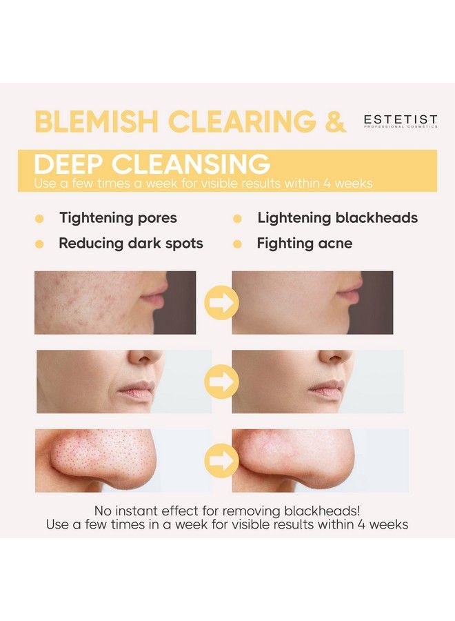 Estetist Turmeric Vitamin C Clay Face Mask Stick Set For Dark Spots Oil Control And Balance Facial Mask Deep Pore Cleanser Blackhead Remover Antiacne Treatment For All Skin Types Gift Pack Of 3 - Image 5