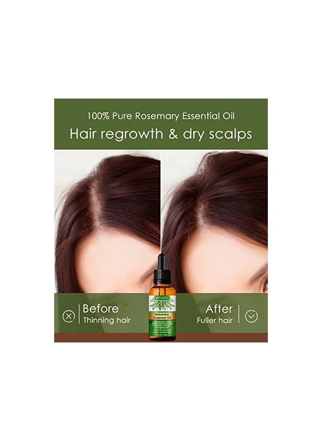 oaoeye - Oil For Hair Growth Rosemary Essential Oils 100% Pure Natural For Hair Growth Face Care Aromatherapy Rosemary Hair Oil - Image 1