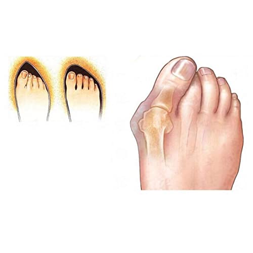 Digital Shoppy 1 Pair Silicone Big Toe Separator Thumb Bunion. (SMALL) - Image 3