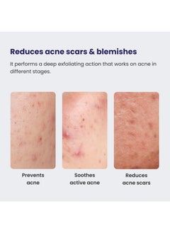 RE' EQUIL Re'Equil 0.5% Retinol Night Cream Makes Skin Youthful & Smooth Prevents Fine Lines & Wrinkles Unisex All Skin Types 30G  - Image 4