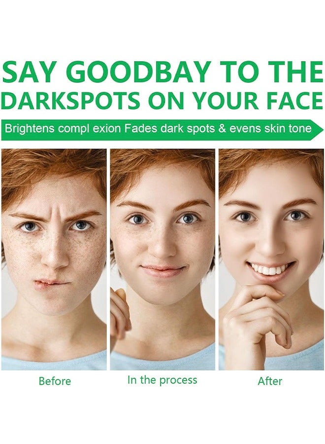 هومتوبس كريم مرطب للبشرة يحتوي على الريتينول والكولاجين وفيتامين سي، مزيل للبقع الداكنة للوجه والجسم، يقلل من تصبغات فرط الميلانين، يخفف من الكلف، النمش، والبقع الشمسية، يوحد لون البشرة، مزيل لبقع الشيخوخة بحجم 50 جرام - Image 5