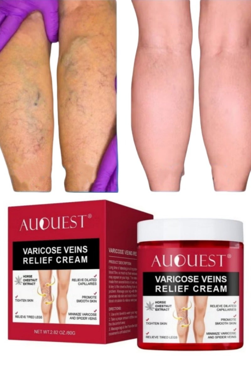 AuQuest Varicose Veins Treatment Cream with Horse Chestnut – 80g Pain Relief for Legs & Hands | Reduces Inflammation, Phlebitis & Angiitis | Promotes Smooth Skin  - Image 1