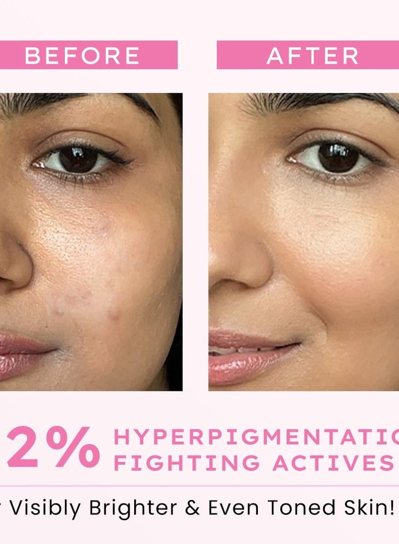 HYPHEN Advanced De-Pigmentation Serum For Hyperpigmentation, Melasma, Dark Spots & Scars With 2% Kojic Acid | Visibly Brightens & Even Tones Skin - 30ml - Image 4