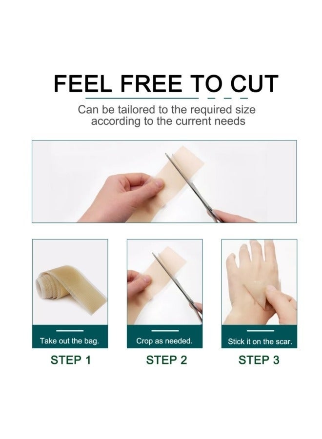 إليمي السيليكون ندبة شريط لاصق ندبة شريط السيليكون ندبة قابلة لإعادة الاستخدام المهنية لإزالة ندبة للحروق الجراحية - Image 5