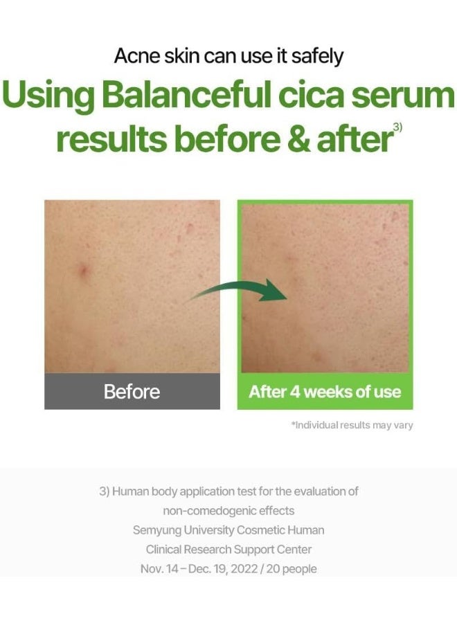 Torriden Balanceful Cica Serum 50Ml – Soothing Centella Asiatica Hydrating Serum For Sensitive, Oily & Acne-Prone Skin, 1.69 Fl Oz - Image 3