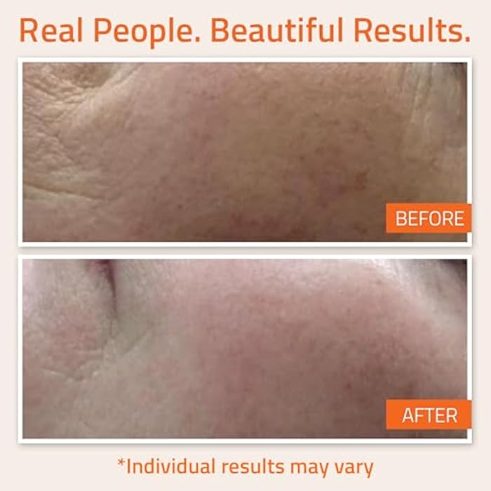 YEOUTH Vitamin C Face Serum with Hyaluronic Acid, Hydrating Vitamin C Serum for Face, Facial Serums Targets the Appearance of Dull Spots 1oz - Image 4