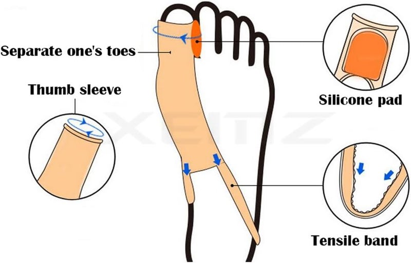 comfrt Bunion Corrector, Toe Hallux Valgus Orthodontic Seperators, Tailors Bunion Relief System Socks Sleeves, Foot Toe Protector Divider Straightener Ball of Foot Cushions, for Big Hammer Toe (2) - Image 3