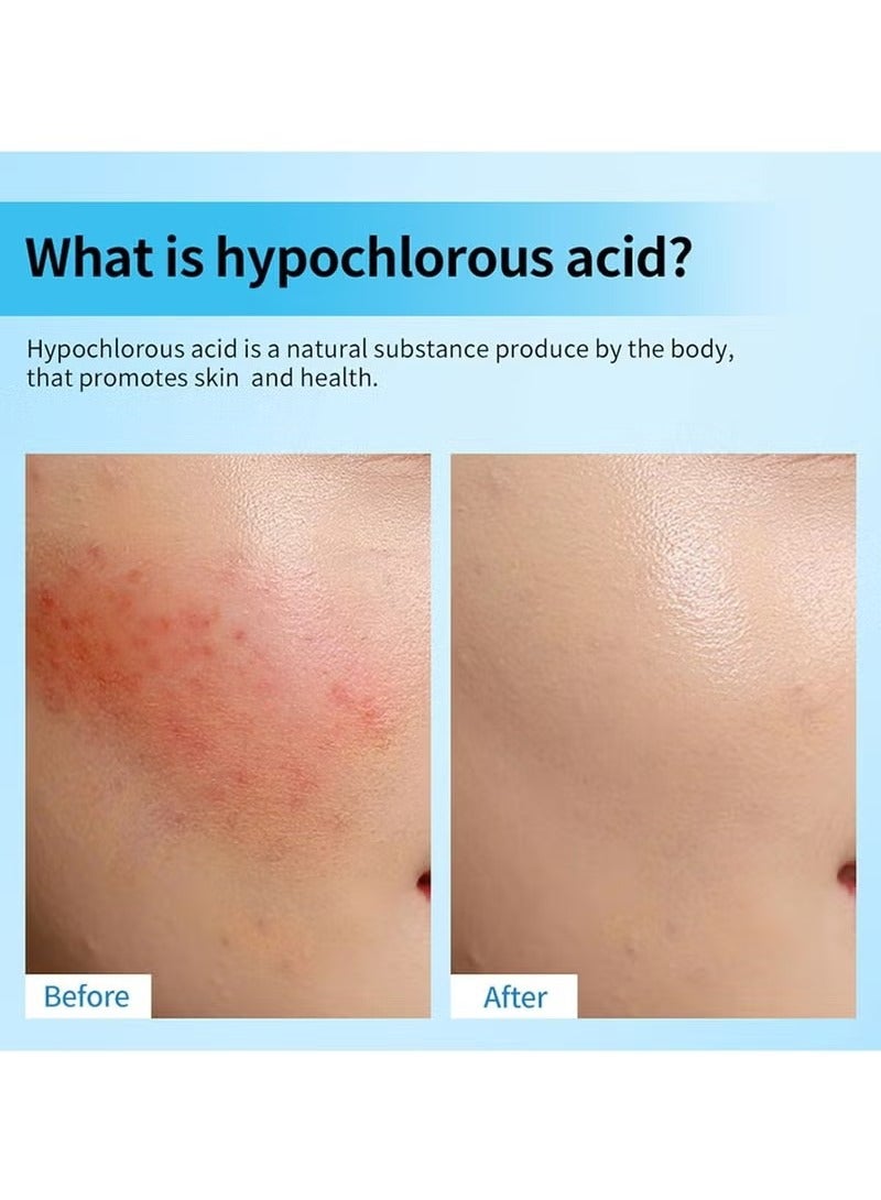 lakerain Hypochlorous Acid Spray for Face and Skin, Non-Irritating Hypochlorous Acid Spray & Eyelid Cleanser Solution to Remove Oil & Debris, Acne, Piercing Aftercare, Calm Redness, 2.2 fl oz - Image 3