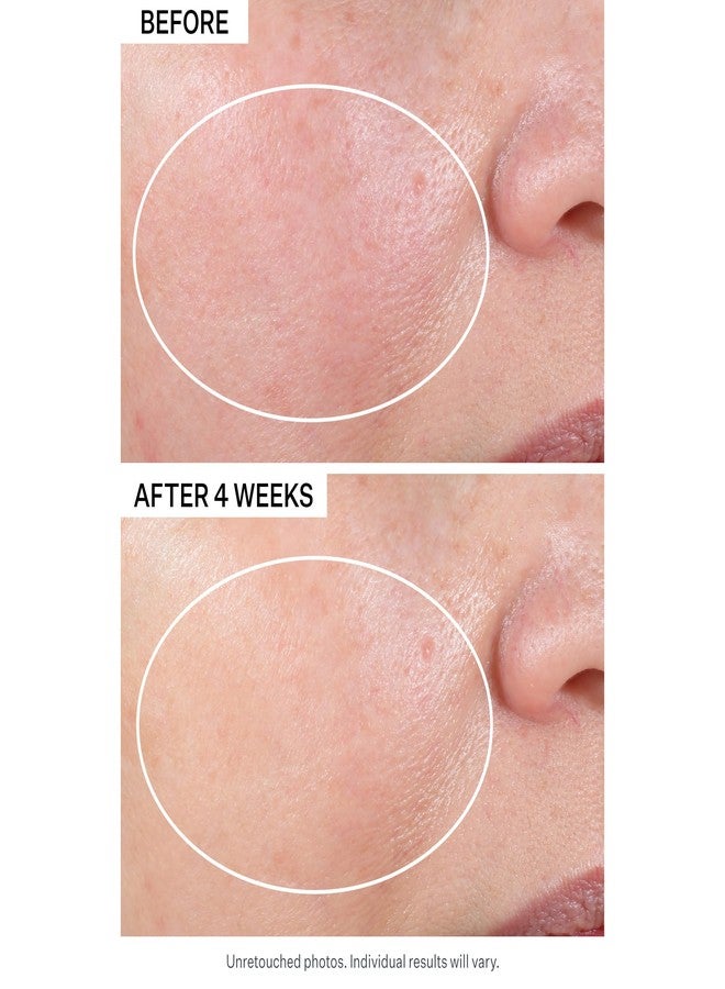 Strivectin مجموعة اكتشاف سترينفيكتين المتقدمة مع مرطب الليل بالريتينول، 1 أونصة، كريم العين متعدد التصحيح 0.5 أونصة، مجموعة من قطعتين للتجاعيد والخطوط الدقيقة - Image 5