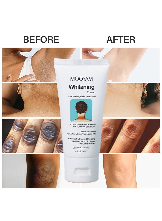 MOOYAM Whitening Cream With Retional,Lactic Acid & Urea - Dermatologist Tested Retinol Cream , Hyperpigmentation Removal Cream , For Dark Body Parts like Neck Ankles Knuckles Armpits 50g - Image 1