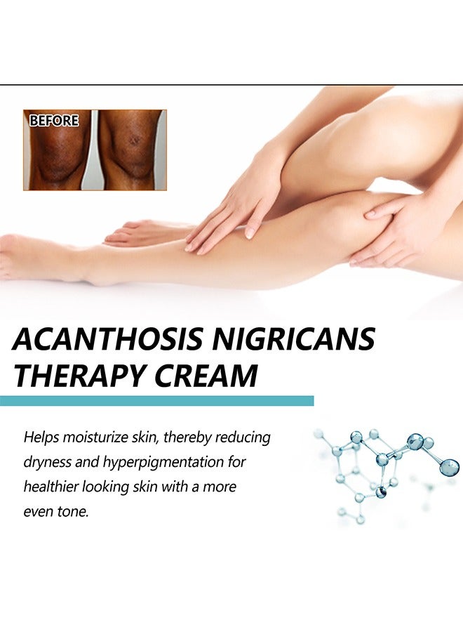 MOOYAM Whitening Cream With Retional,Lactic Acid & Urea - Dermatologist Tested Retinol Cream , Hyperpigmentation Removal Cream , For Dark Body Parts like Neck Ankles Knuckles Armpits 50g - Image 4