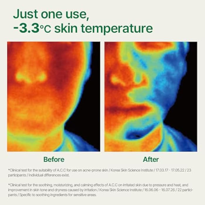 Pyunkang Yul PKY Ultimate Calming Solution Toner Pad for Sensitive Skin with Patented Ingredients, Intensely Calms & Soothes Rednes with CICA & Tea Tree, Korean Skincare (70 Pads) - Image 4