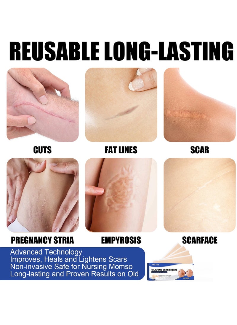 SOUTH MOON - Scar Remover Patch, Silicone Scar Sheets For Scars Stretch Mark Treatment Waterproof, 4 Reusable Sheets - Image 1