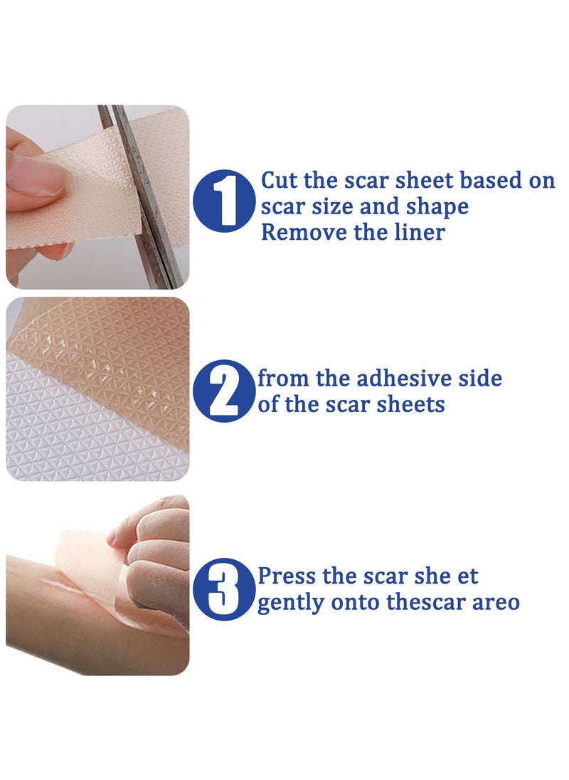 SOUTH MOON - Scar Remover Patch, Silicone Scar Sheets For Scars Stretch Mark Treatment Waterproof, 4 Reusable Sheets - Image 1