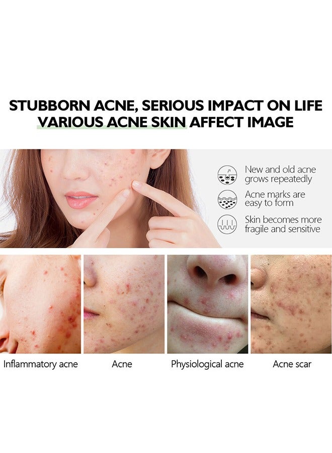 BIOAQUA Acne Removal Essence, Brightening Treatment Serum,Face Serum for Sensitive Skin and Acne 30ml - Image 4