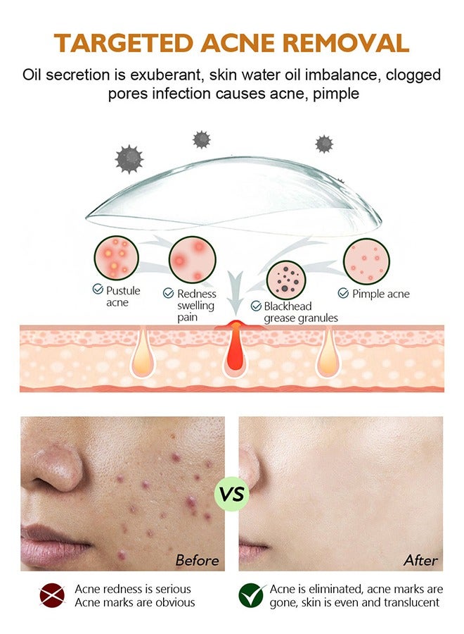 BIOAQUA Acne Removal Essence, Brightening Treatment Serum,Face Serum for Sensitive Skin and Acne 30ml - Image 3