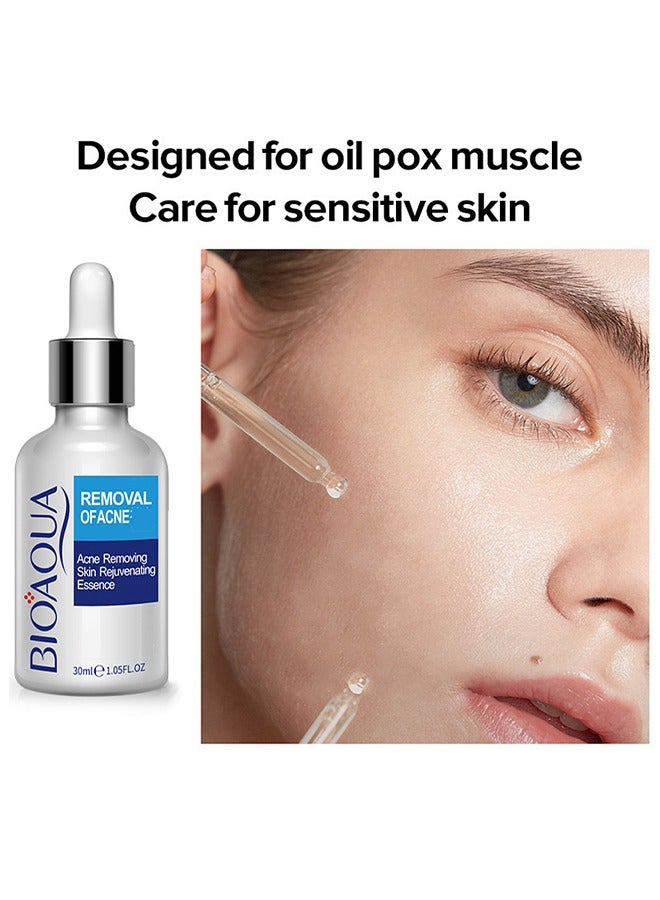 BIOAQUA Acne Removal Essence, Brightening Treatment Serum,Face Serum for Sensitive Skin and Acne 30ml - Image 2