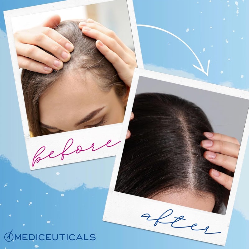 Mediceuticals Therapro Cellagen Follicle Revitalizer for Women - 250ml Hair and Scalp Treatment - Image 5