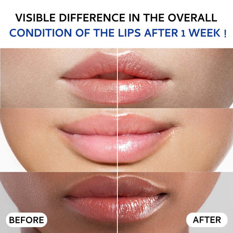 Tobcharm Lip Sleeping Mask (20g), Collagen Lip Mask Overnight, Lip Plumper with Hyaluronic Acid, Peptide Complex Lip Balm for Lip Wrinkle Repair and Plumping, Natural Hydration for Smooth Lips - Image 3