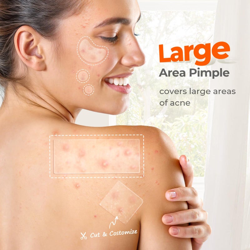 TKTK Large Pimple Patches for Face, 68 x 27 mm XL Hydrocolloid Bandages, Big Acne Patches for Body, Forehead, Chin, Nose, Chest and Back Blemish Zit Breakouts (Strip, Contoured, Dot 5 Sizes 136 Count) - Image 3