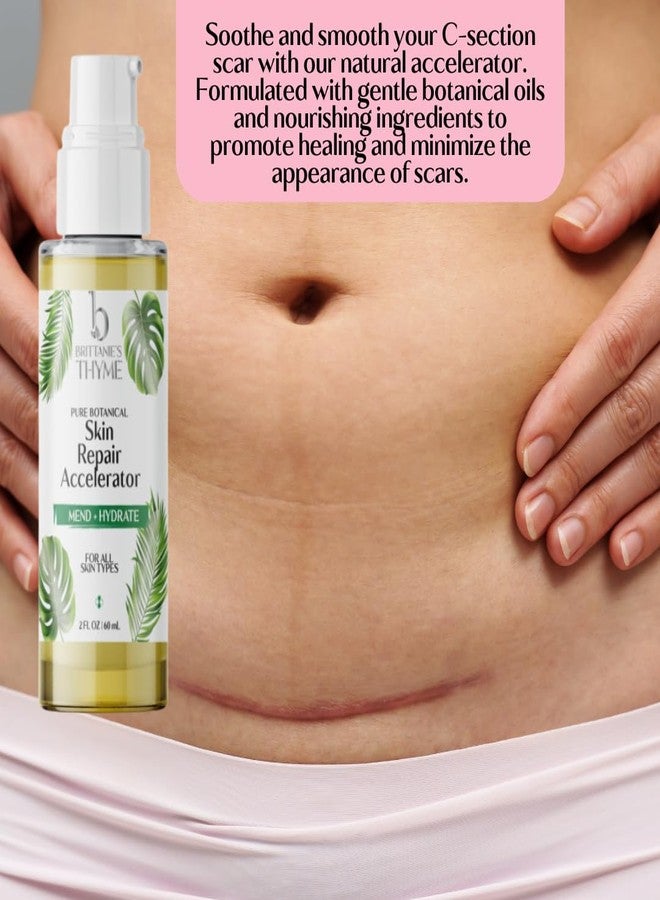 Brittanie's Thyme Skin Repair Accelerator For C Section Recovery, Scars and Stretchmarks | Natural, Non-Toxic Healing Treatment, Dermatologist Recommended, Deeply Nourishes, Reduces Wrinkles - Image 3