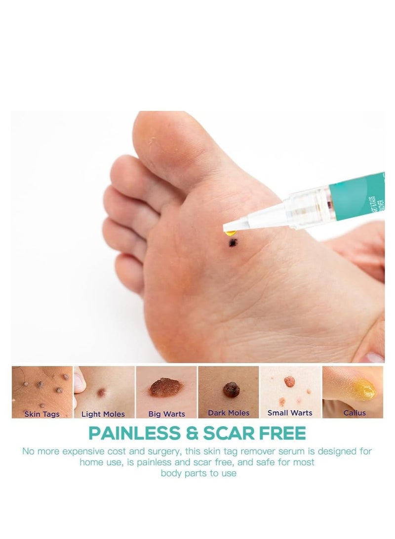 ximonth Skin Tag Remover, 4 Pcs Wart Remover Pen, Wart Treatment Effective Remover for Foot & Hand Warts, for Small to Large Sized Skin Tags and Wart for All Body Parts - Image 4