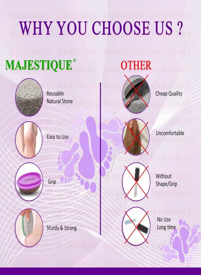 Majestique 2PCS Pumice Stone With Grip Pedicure Tools Hard Skin Callus Remover for Remove Dead Skin. Heels. Elbows. Hands (Multicolor) - Image 5