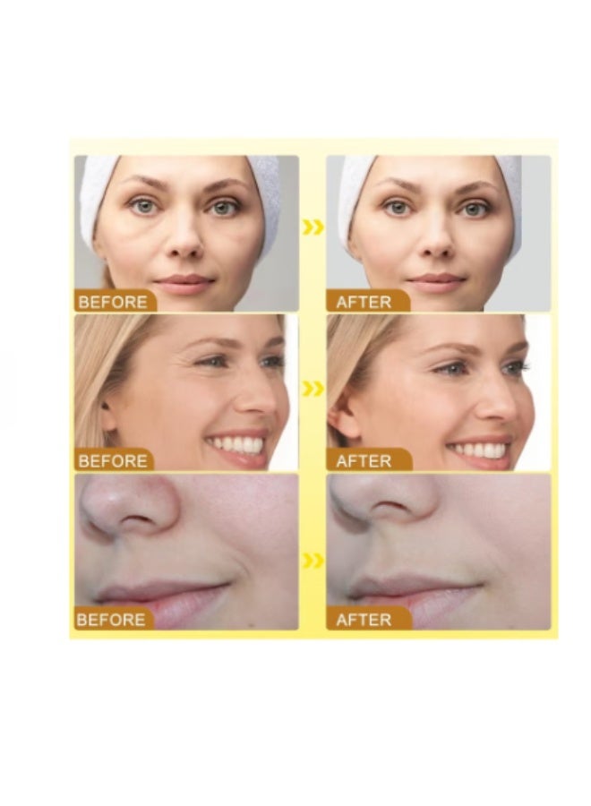 أوهو كريم بوتوكس لإزالة التجاعيد بسم النحل - 20 جم - Image 4