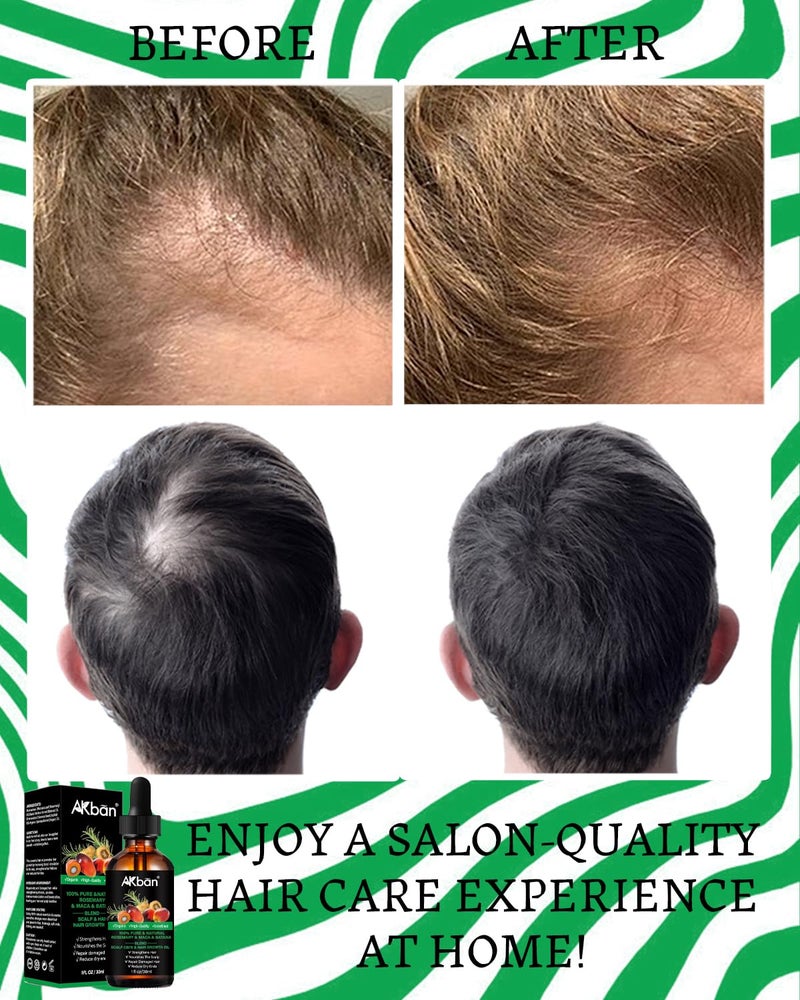 AKBAN Batana Oil for Hair Growth, with Rosemary Oil Maca Argan Jojoba Oil, Promotes Hair Thickness, Nourish Scalp and Hair for All Hair Tapes | Glass Bottle with Dropper | 1fl oz + 1 fl oz - Image 3