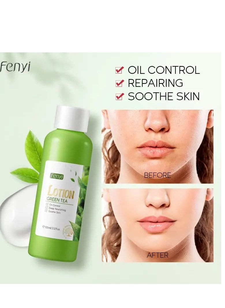 فيني لوشن الشاي الأخضر للتحكم في الزيت من فيني - 100 مل - Image 3
