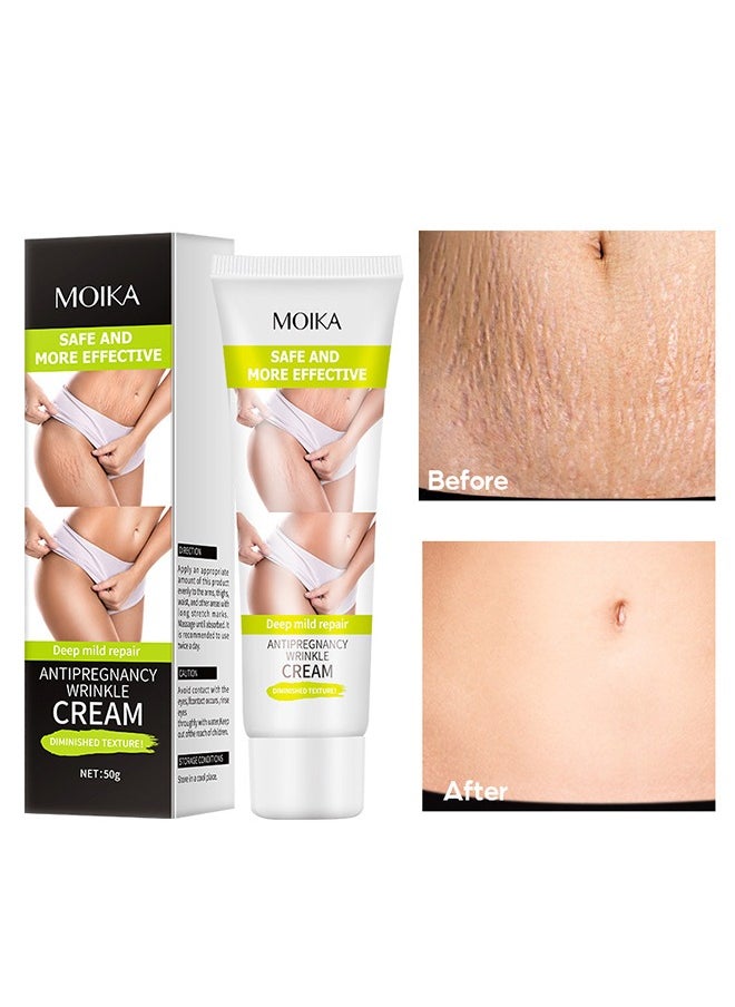MOIKA - Antipregnancy Wrinkle Cream-Natural Plant Essence Formula Maternity Skin Treatmentpregnancy Scarsrepair Cream 50g - Image 1